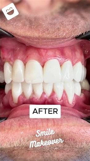 🚨 This isn't the end of Justin's smile transformation... it's only the beginning.