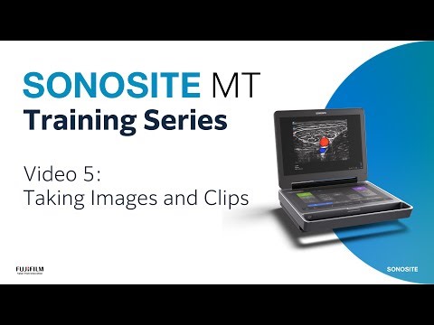 Sonosite MT - Taking Images and Clips