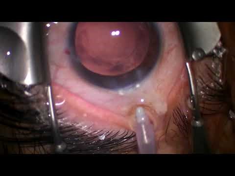 2025 10 09 141636 panoptix pro