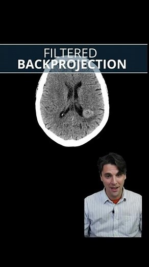 Filtered Backprojection FBP (#shorts) [CT image reconstruction]