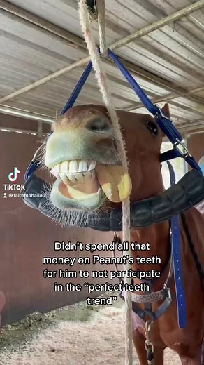Yes, he did have braces. #fyp #foryou #rodeo #barrelracer #horses #barrelhorse #braces