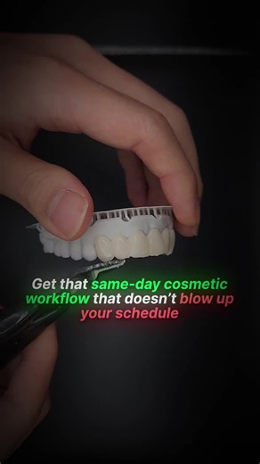 Nothing kills a same-day workflow like a temp that breaks right before delivery. 🤯 This minimum-thickness guideline will help your next 3D-printed temp hold up with better fit and strength. 💪 #dental3dprinting #digitaldentistry #3dprintingtips #smilemakeover #smiledesign | Evident