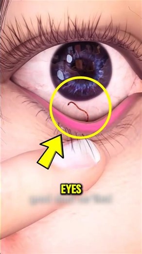 If you ever see WORMS in YOUR EYES...