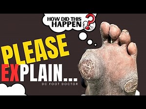 Please Explain: How Did This Happen?