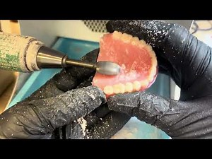 Watch These Dentures Transform Before Your Eyes!