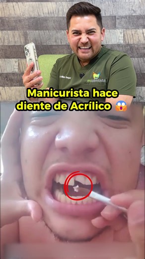 Manicurista le hace DIENTE de ACRÍLICO a su esposo 😱 ¿cómo le quedó? 📍 Nos ubicamos en Tijuana para cualquier cita #dentista #odontologo #brackets #braces