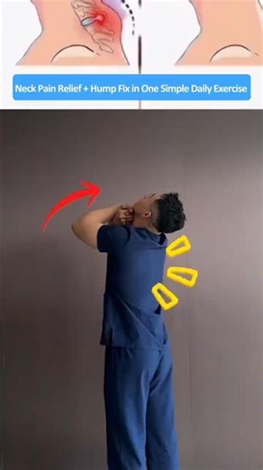One Daily Neck Mobility Exercise to Reduce Discomfort, Fix Hump, and Improve Posture