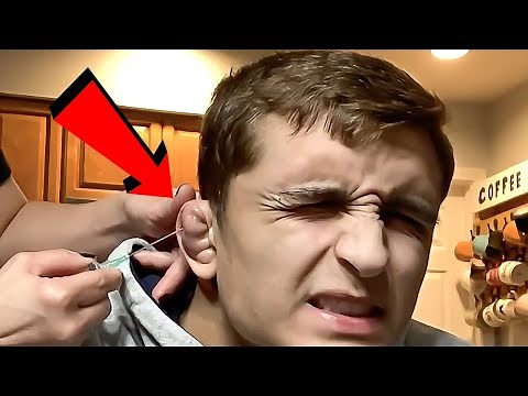 Draining A Cauliflower Ear
