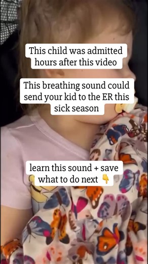 Leslie Brewer, CRNP | Pediatric Health Expert + Mom of 5 on Instagram: "That harsh, high-pitched breathing sound you’re hearing is called stridor. Stridor = upper airway narrowing, usually around the larynx or trachea — and it sounds loudest when a child breathes in. In this little girl, the cause is FLU A. Flu can cause significant inflammation in the upper airway, especially in young children, leading to swelling that creates this scary sound. What parents should know: • Stridor is different f