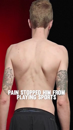 By • @functionalpatterns This is what happens when the body starts getting support in the right places. From January 2023 to June 2024, Tommy completed two rounds of 16 sessions, with a 6 to 9 month break between them with @ryan.john.parr @fp_whitebearlake Shoulder pain went from 5/10 to 0/10. Sciatica went from 7/10 to 0/10. But the bigger story is what changed underneath those symptoms. His gait improved. His hip and lumbar stability improved. His ribcage started rotating more symmetrically. H
