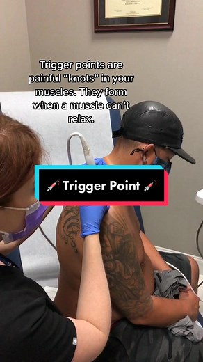 Getting rid of those “knots” #triggerpoint #injection #muscleknots #sportsmedicine #doctor #painmanagement