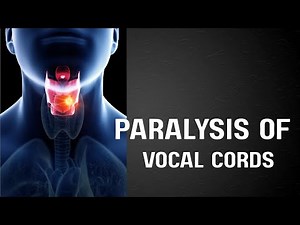 What to do when you have paralysis of vocal cords