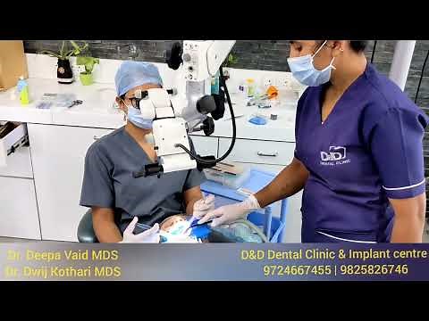 RCT Root Canal Treatment under Microscope and Rubber dam