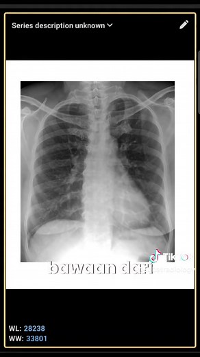 Explore DICOM and X-Ray Applications in Radiology