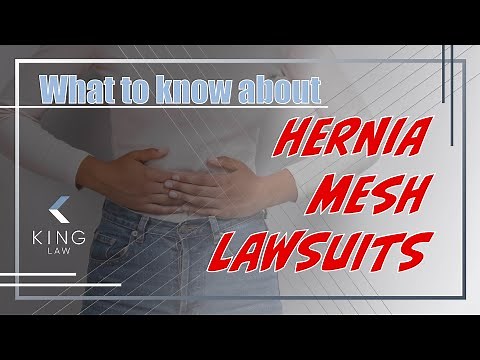 What to Know about the Hernia Mesh Lawsuit #legaladvice #attorney #podcast #legal