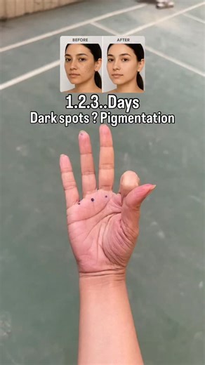 14K views · 1K reactions | Tired of stubborn pigmentation?  Try...