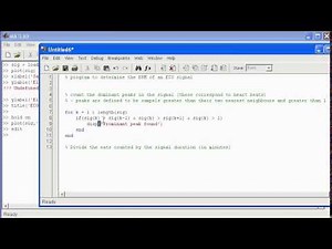 Signal Analysis using Matlab A Heart Rate example