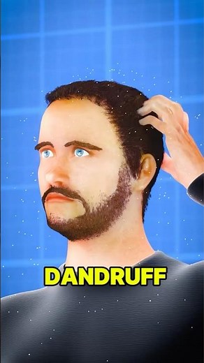 Stop Scratching! The Shocking Truth About Dandruff You Need to Know