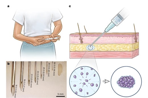 New Birth Control Shot Transforms Into a Long-Lasting Implant—No Clinic Required