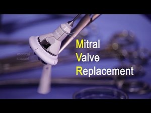 Mitral Valve Replacement (MVR)