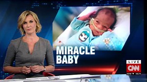 Doctor on delivering baby to brain-dead mother