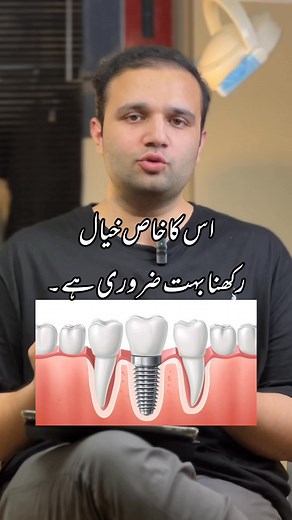 Just got dental implants? 🦷 Take care of them like your natural teeth brush and floss daily. At first, speaking or eating might feel a bit tricky. Give yourself some time to adjust. Soon, it will become a habit, and your implants will feel just like your own teeth. Smile with confidence! 😁 #PeshawarDentist #drzarakhan #DentalImplants #HealthySmile #OralCare #SmileConfidence #DentalCare | Dr Zarak Khan - TDL