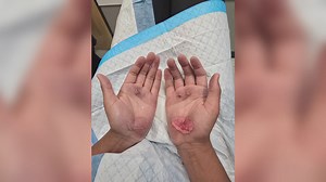 Woodville Middle School teacher removed after students injured in 'bear crawl' on track