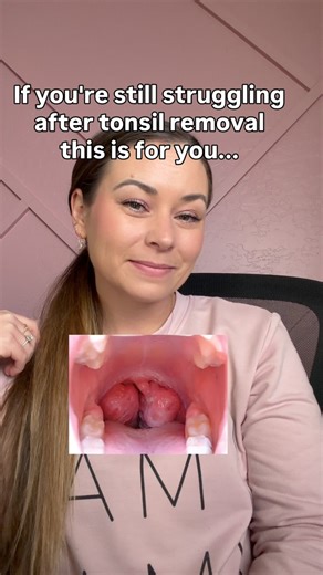 Chelcie Gjellum || Mouth breathing | Tongue tie | Sleep on Instagram: "If you’re still struggling after tonsil removal… this is for you. Because removing the tonsils may clear the blockage, but it doesn’t retrain the body. Here’s what often gets missed: • 👅 Tongue posture is still low • 😮 Mouth breathing continues • 💤 Sleep is still restless • 🧠 The nervous system stays stuck in survival mode • 🦴 The airway doesn’t develop the way it should Tonsillectomy might be part of the solution, but i