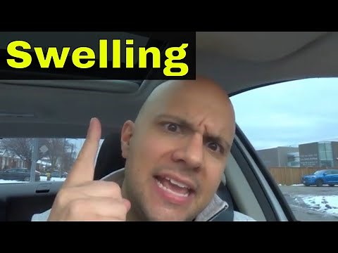 How To Reduce Swelling-Make Swelling Go Down Easily