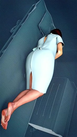 Colon Polypectomy Explained! (3D Animation) #colonpolypectomy #colonoscopy #polypectomy #medicalvideo #coloncancer