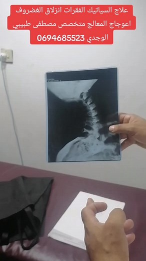Understanding Spine X-rays in Medical Examination