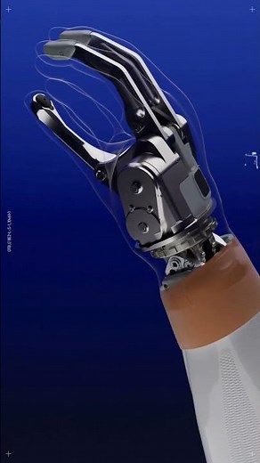Speedhand solution - prosthetic arm | Ottobock
