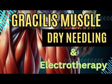 Dry Needling Therapy for Gracilis Muscle | Effective Treatment for Pain Relief & Muscle Recovery