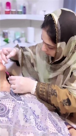 Mono threads face lift + rejuvenation