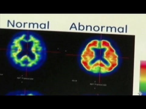 Cutting edge research into memory disorders