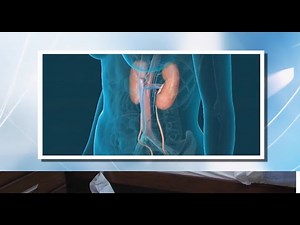 CentraCare Urology - Urinary Incontinence Surgery For Females