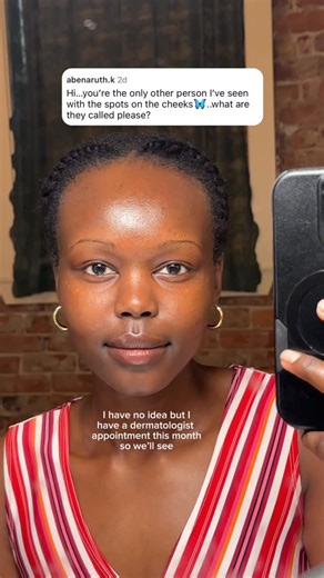 Yar ♡ on Instagram: "I’ve always had these light brown spots, I just call them freckles 😭 they’re on my face, arms, legs… etc and yes I wear sunscreen. I have a derm appt for something else this month but I’ll see about this too :) #skincare #freckles #dermatologist"