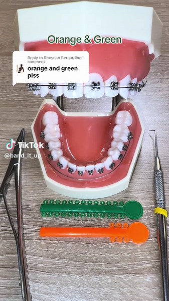 Orange and Green Braces Color Showcase