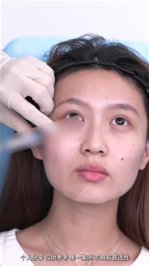 Oh my god Has Micro D0 become a baby #angelababy#Become beautiful#Make a stunning comeback