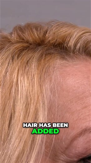 𝐅𝐮𝐥𝐥𝐞𝐫 𝐡𝐚𝐢𝐫, 𝐨𝐧𝐞 𝐬𝐭𝐫𝐚𝐧𝐝 𝐚𝐭 𝐚 𝐭𝐢𝐦𝐞. Introducing the breakthrough MicroStrand technology — where single human hairs are delicately blended between your own, creating the illusion of naturally fuller hair. It’s so seamless, even up close, it’s nearly impossible to detect. 𝐻𝑎𝑖𝑟 ℎ𝑎𝑠 𝑏𝑒𝑒𝑛 𝑎𝑑𝑑𝑒𝑑 𝑑𝑖𝑟𝑒𝑐𝑡𝑙𝑦 𝑎𝑡 𝑡ℎ𝑒 ℎ𝑎𝑖𝑟𝑙𝑖𝑛𝑒 — 𝑦𝑒𝑡 𝑎𝑙𝑙 𝑦𝑜𝑢 𝑠𝑒𝑒 𝑖𝑠 ℎ𝑒𝑟 𝑜𝑤𝑛 𝑔𝑟𝑜𝑤𝑖𝑛𝑔 ℎ𝑎𝑖𝑟. Want to see how it works? Watch as we gently remove t