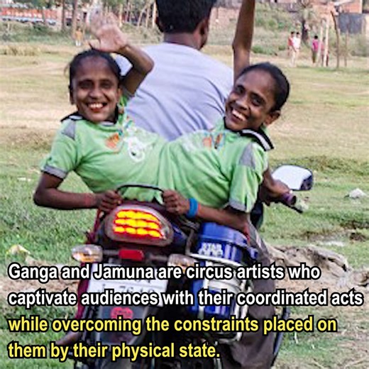 66K views · 365 reactions | Most Unusual Twins Who Were Born Different! | Colors Of Nature | Facebook