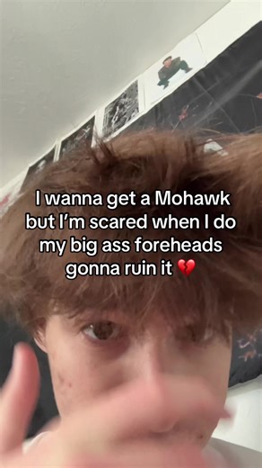 Receding hairline at 17 💔 but I’ve also seen someone use a bandana to cover up their forehead when they had a Mohawk maybe I could do something like that #fyp #hair #punk #cancerslug #funny