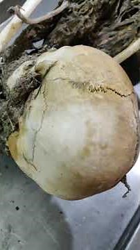 #postmortem examination of #skeletonized remains of some unknown body