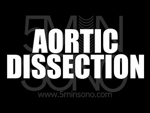 Aortic Dissection