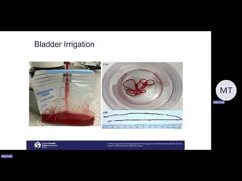 Continuous Bladder Irrigation