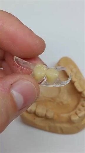 Key Options to Replace Missing Teeth: Restore Your Smile and Improve Oral Health in 2025 | Caleb Meyer