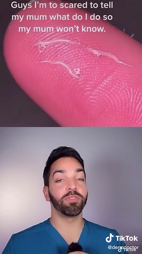 Don’t scratch and sniff #dermdoctor #pinworms #dermatologist