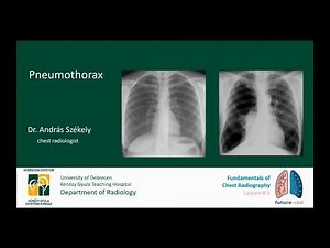 Fundamentals of Chest Radiography - Lesson 5.
