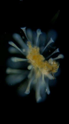 1.6K views | Stentor colony | Science into Images | Facebook