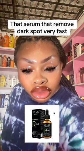 That one products that clear dark spot very fast ✨ Perfumes and skincare Hubs De orator perfumes and skincare hub #serum #fyp #treatment #skincare #trending | Perfumes and skincare Hubs